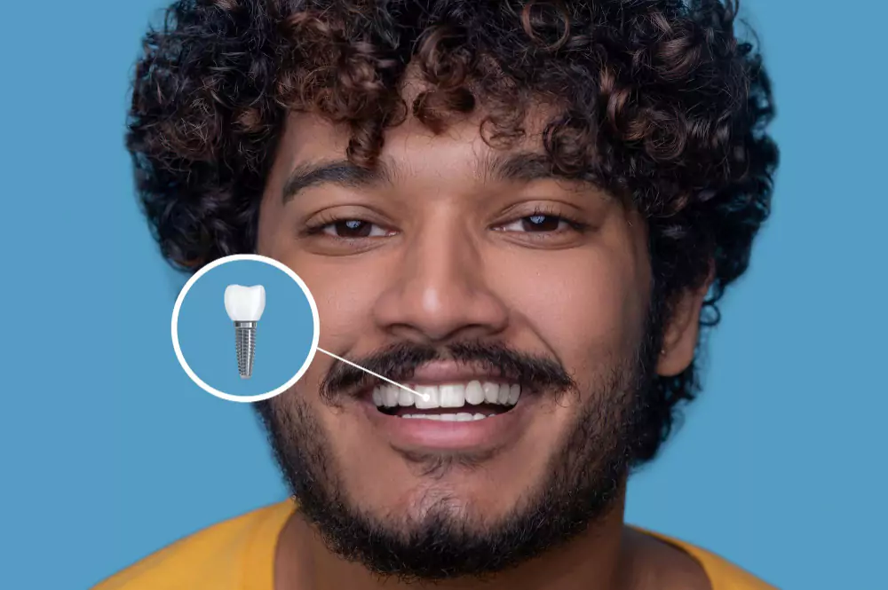/dental-implants/