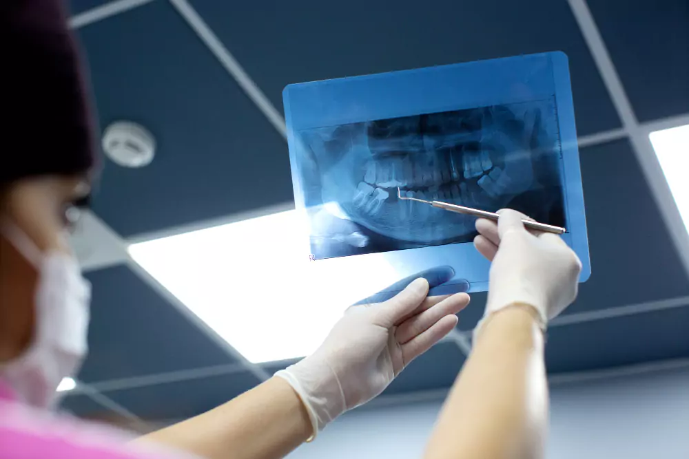Dental X-Ray